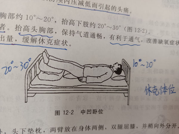 大S為何常臥？深度剖析其背后的多重原因與健康管理之道